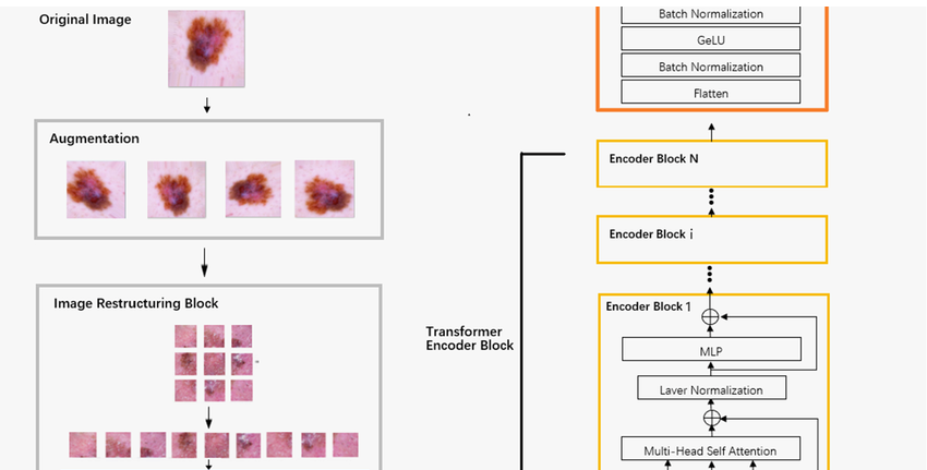 Skin Cancer Classification Paper